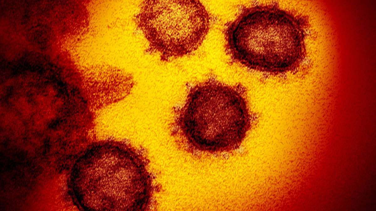 Covid-19: Der Wirkstoff tötet das Coronavirus ab - ein großer Durchbruch in den USA